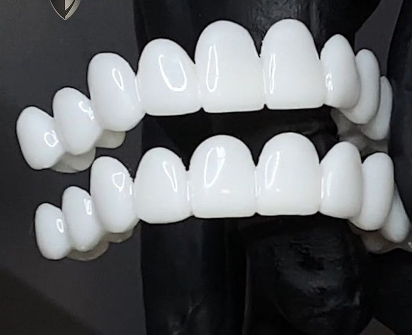 Koadclo | Snap-On Cosmetic Veneers – Instant Smile Cover for Imperfections