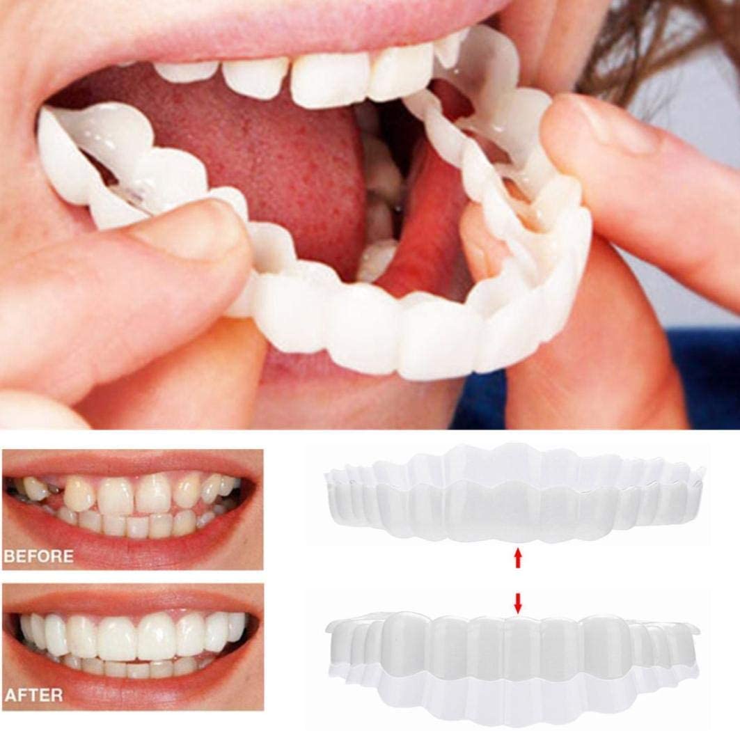 Koadclo | Smile Veneers Set (Upper & Lower Teeth Included)