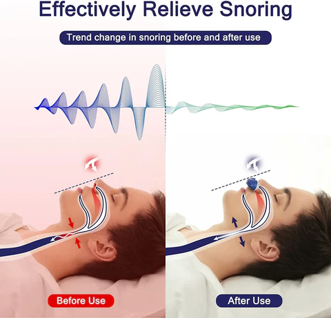 Koadclo | Micro CPAP Sleep Apnea Machine for Travel – Portable Anti-Snoring Device