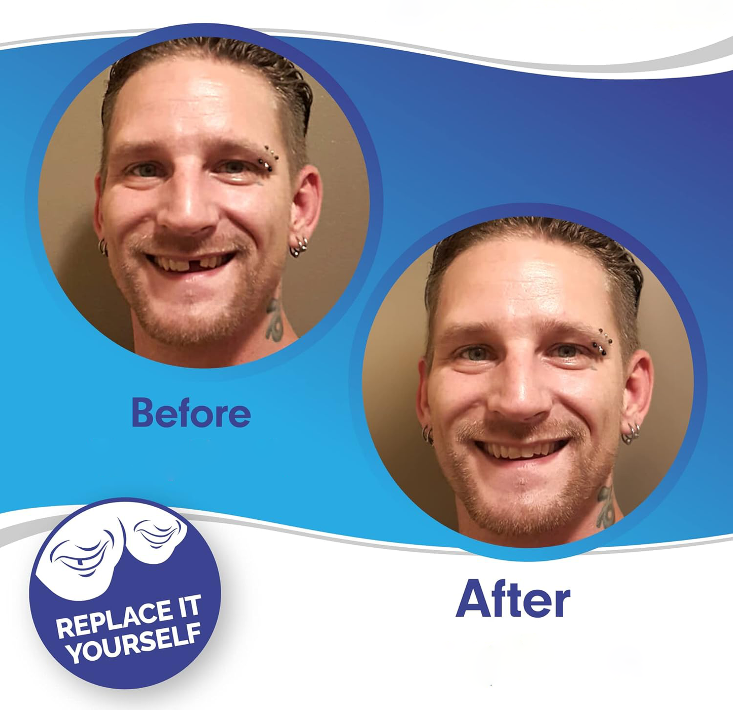 koadclo | Clip On Veneers - Natural Looking Fake Teeth