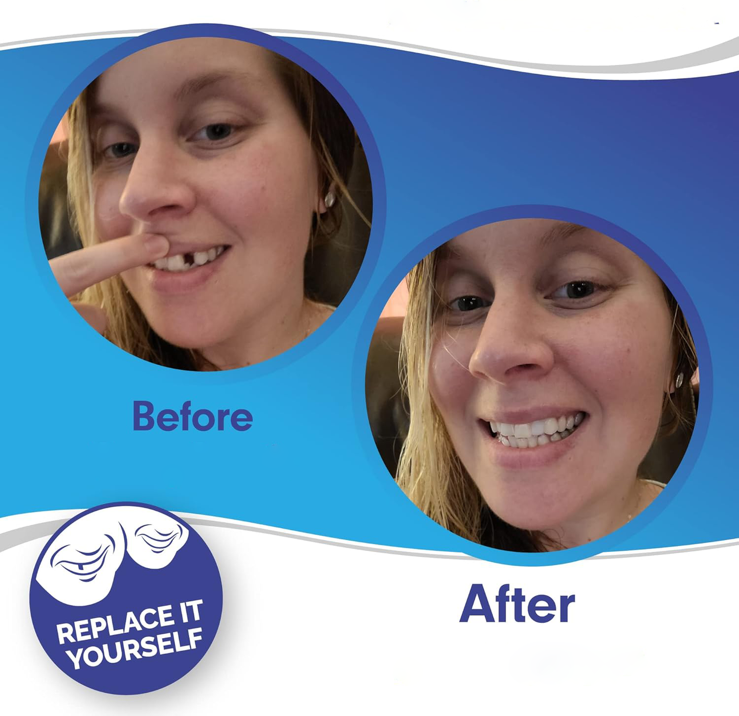 koadclo | Clip On Veneers - Natural Looking Fake Teeth
