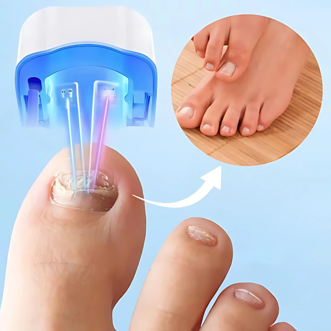 koadclo | Nail Treatment Laser Device for Fungal Care