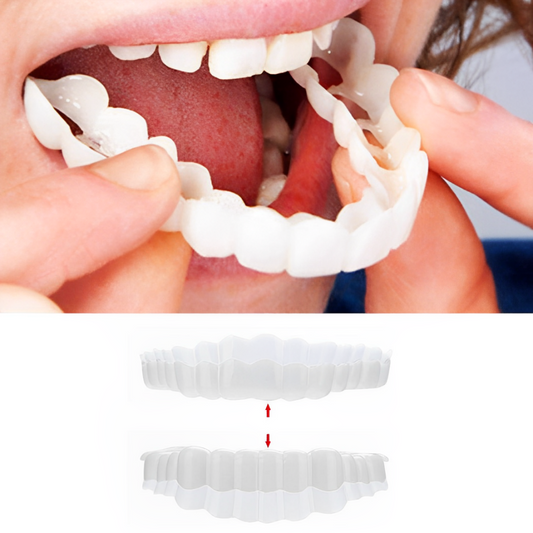 Koadclo | Smile Veneers Set (Upper & Lower Teeth Included)