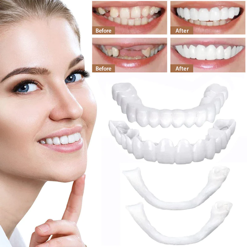 koadclo | Veneers for Teeth with Natural White Finish