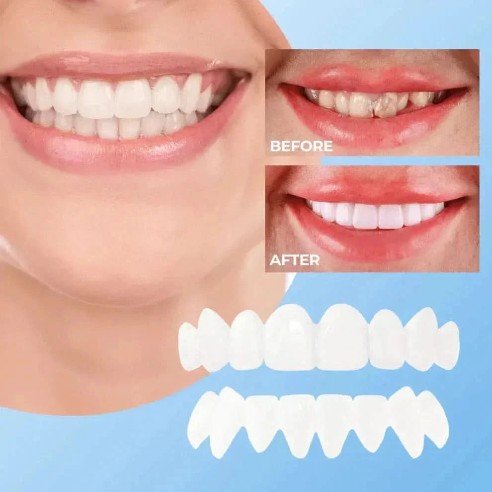 koadclo | Veneers for Teeth with Natural White Finish