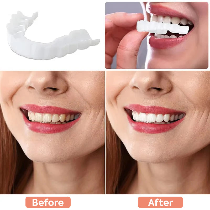 koadclo | Veneers for Teeth with Natural White Finish