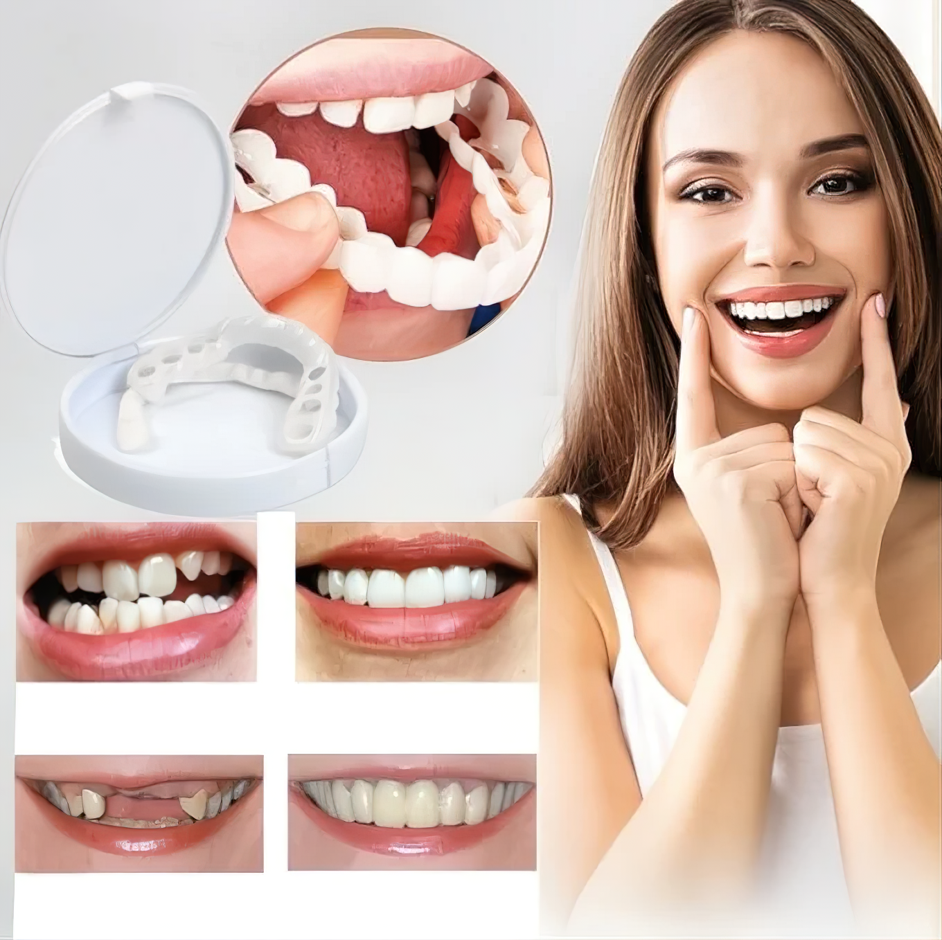 koadclo | Veneers for Teeth with Natural White Finish