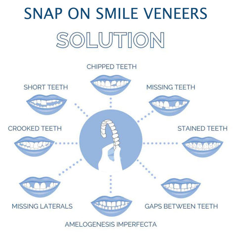 koadclo | Clip On Veneers - Natural Looking Fake Teeth
