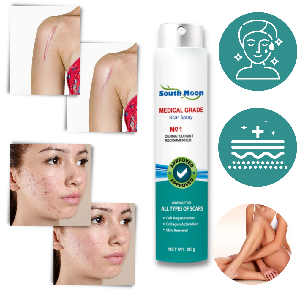 Koadclo | Spray Treatment for Scar Removal – Silicone Scar Healing Spray for Face & Body