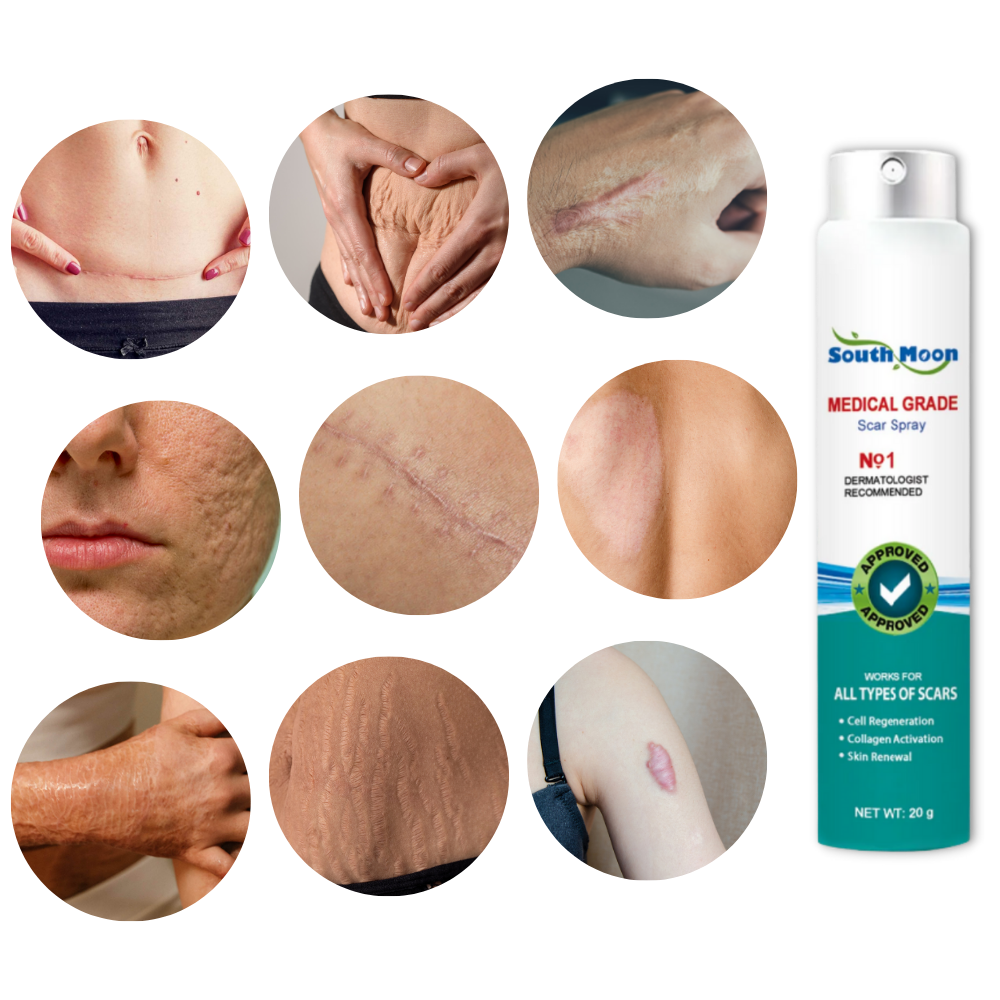 Koadclo | Spray Treatment for Scar Removal – Silicone Scar Healing Spray for Face & Body