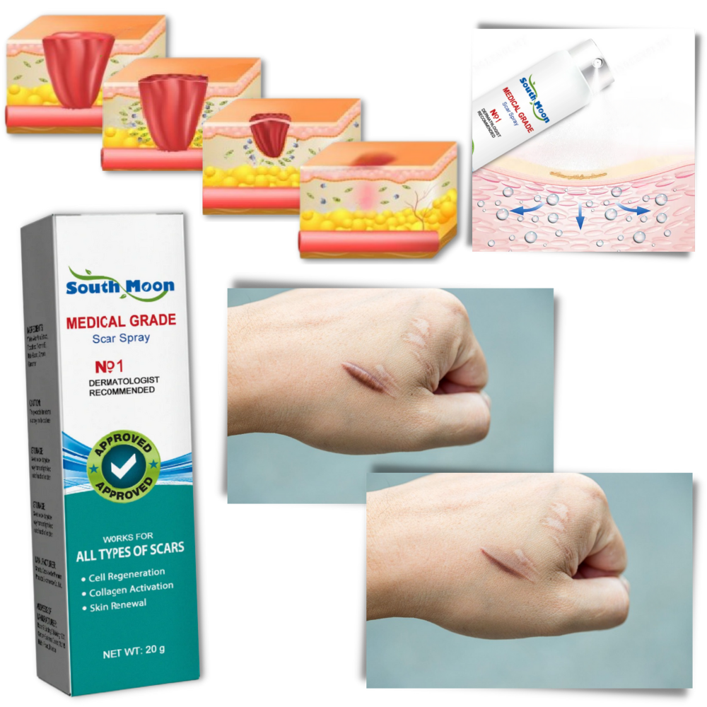 Koadclo | Spray Treatment for Scar Removal – Silicone Scar Healing Spray for Face & Body